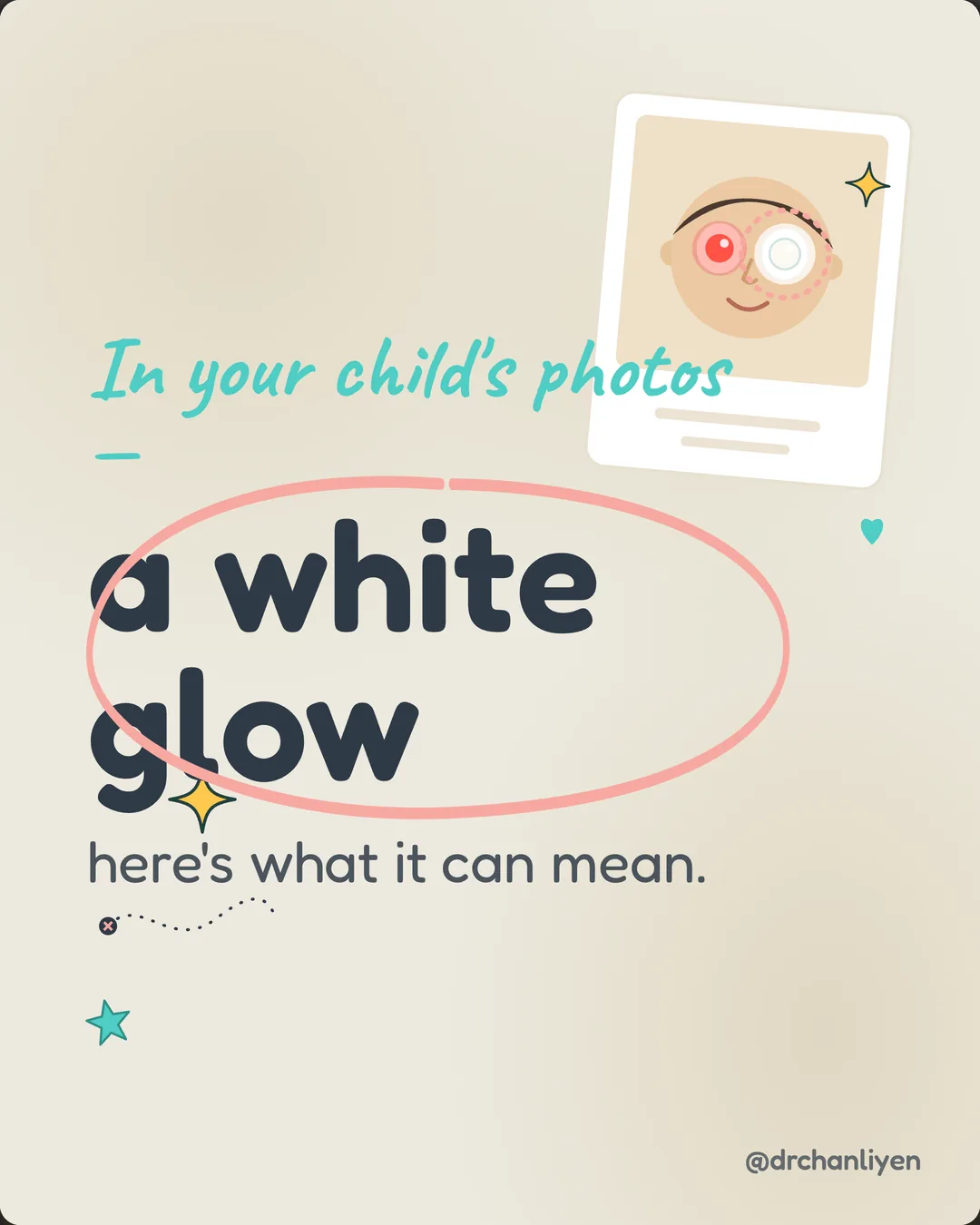 The white glow in photos, slide 1 of 6: In your child's photos, a white glow: here's what it can mean.