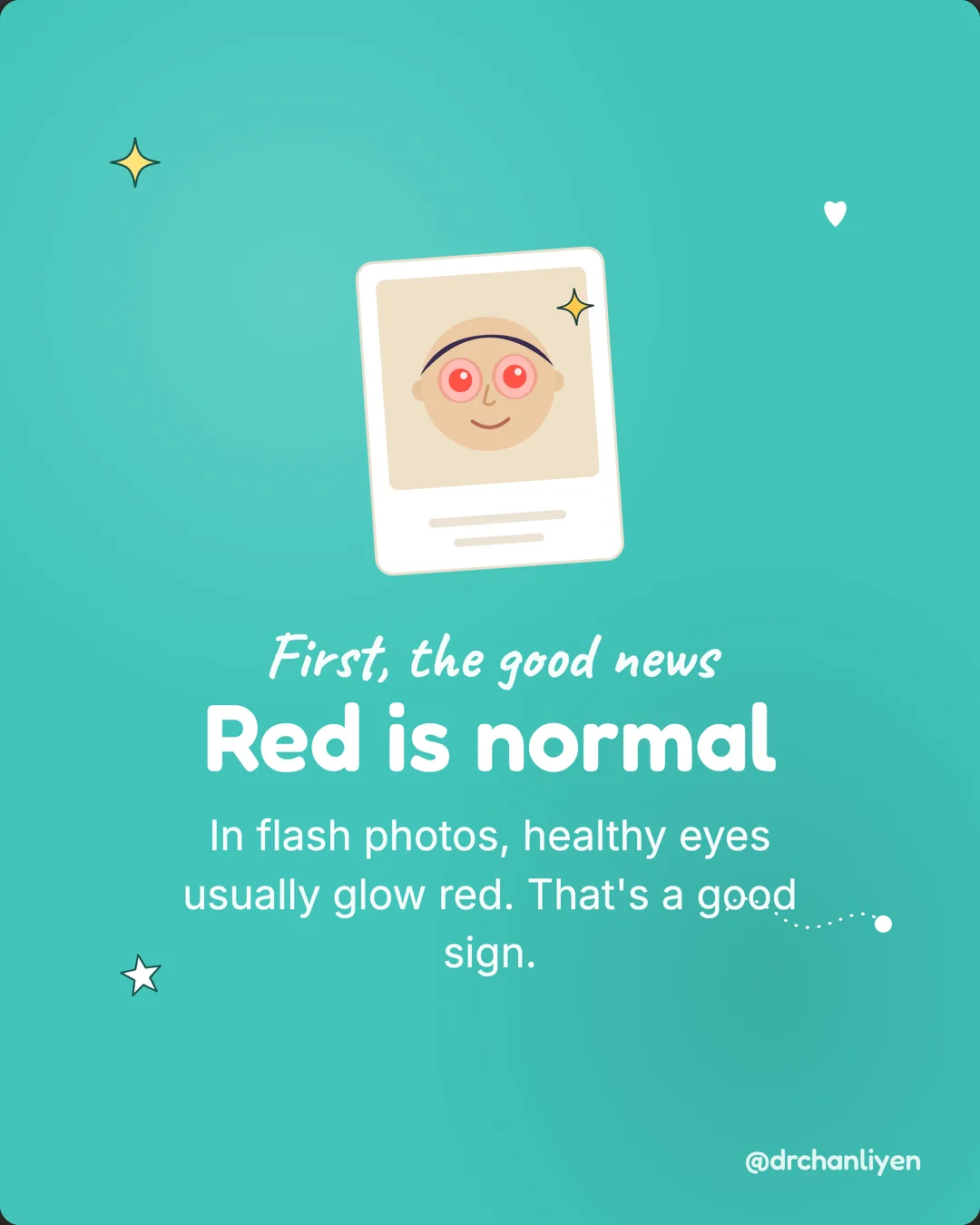 The white glow in photos, slide 2 of 6: First, the good news. Red is normal. In flash photos, healthy eyes usually glow red. That's a good sign.